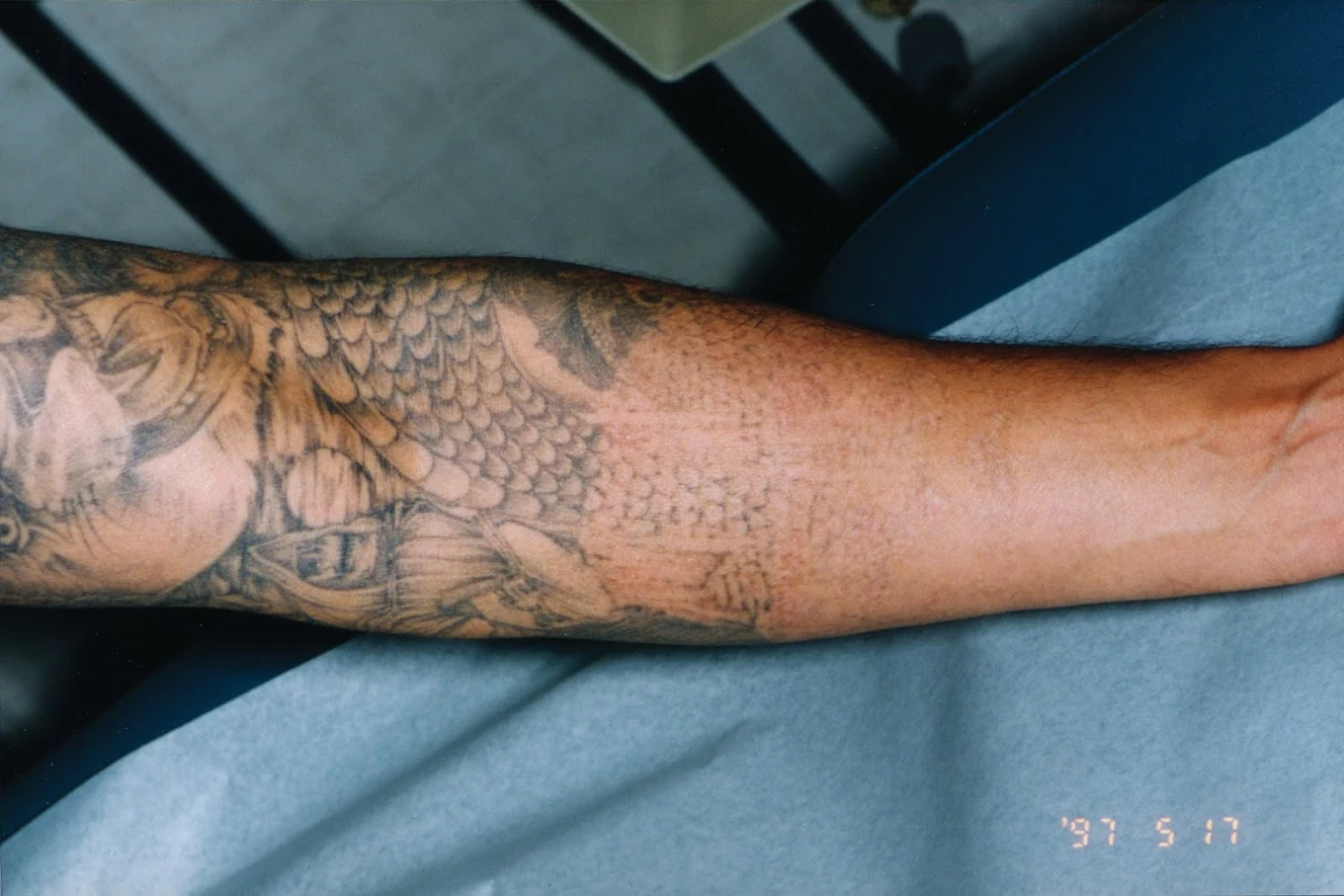 Erase The Canvas clinic photo