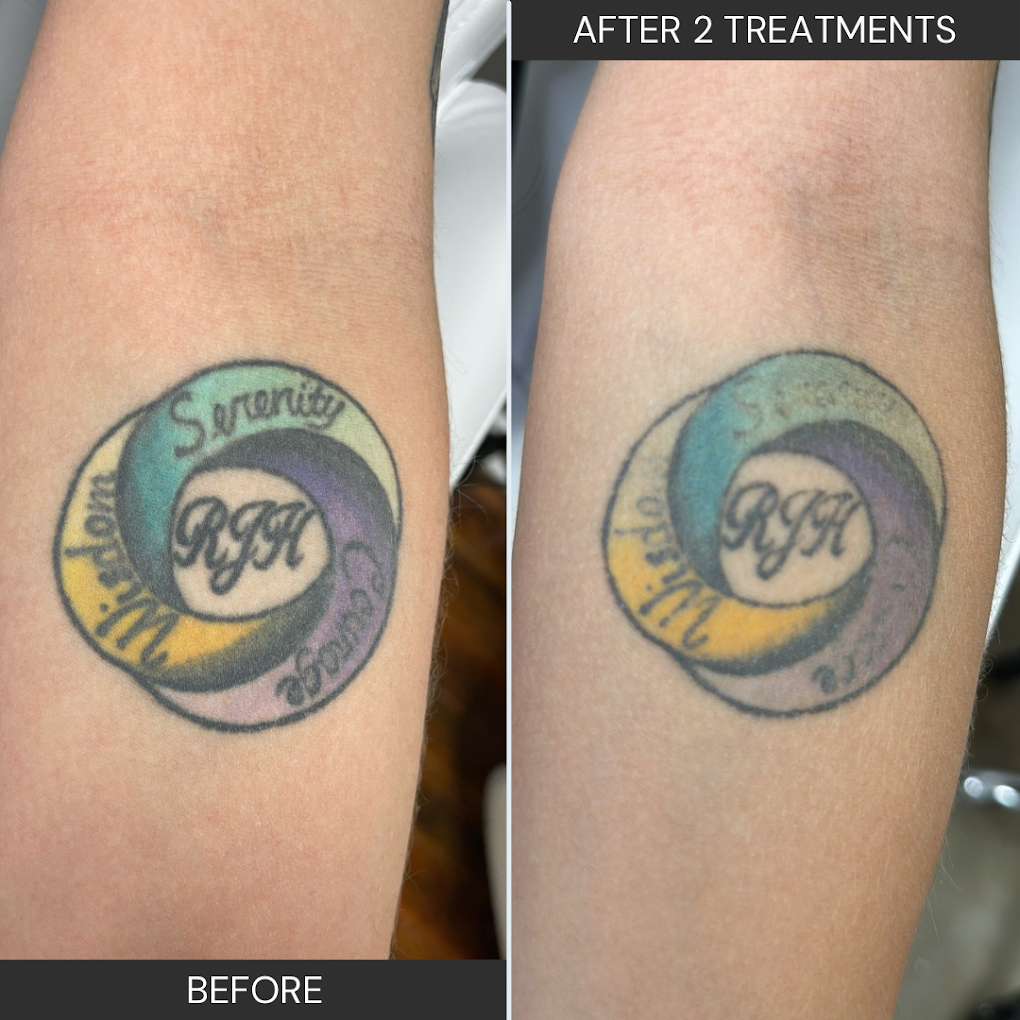 Ink-Remedy Tattoo Removal clinic photo