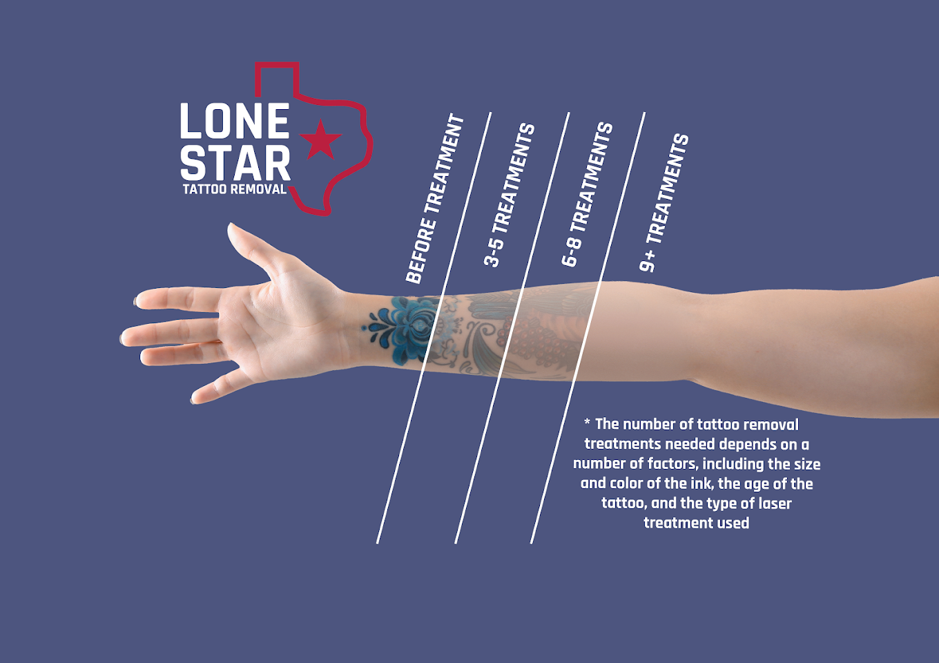 Lone Star Tattoo Removal clinic photo