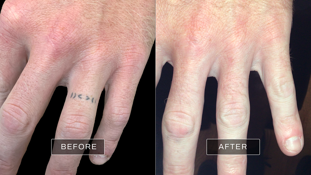 Removery Chesterfield clinic photo