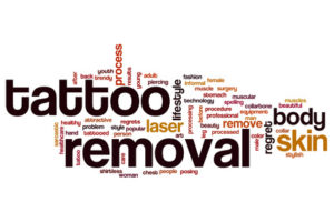 tattoo-removal-words